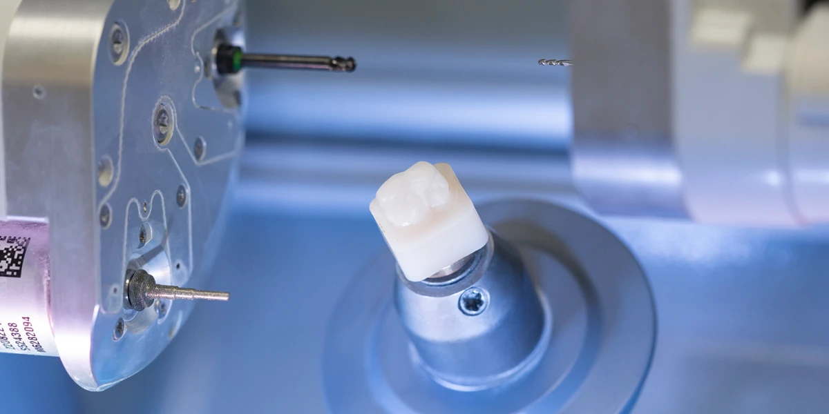 Última Tecnología en Clínica dental Pozuelo